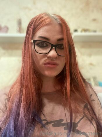 albinoteen