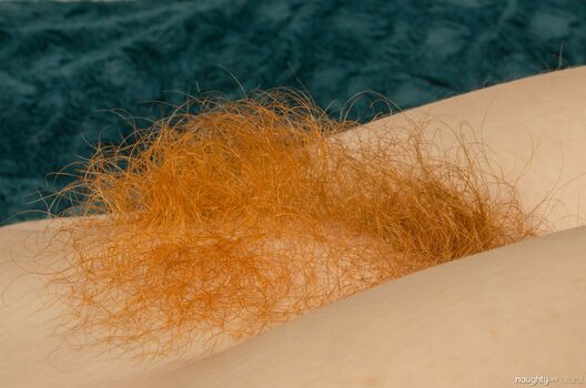 Hairy Women