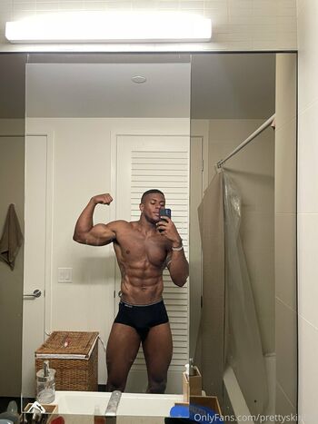 prettyskinboi