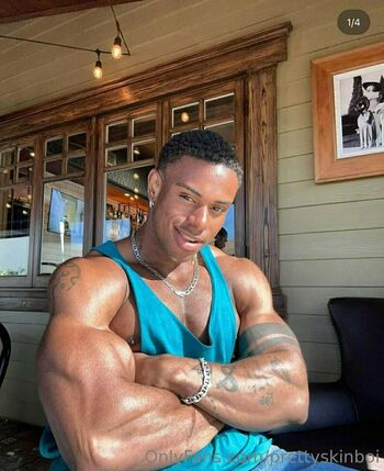 prettyskinboi